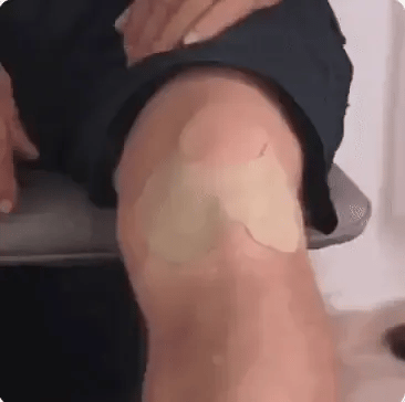 Aplicación del parche en la rodilla